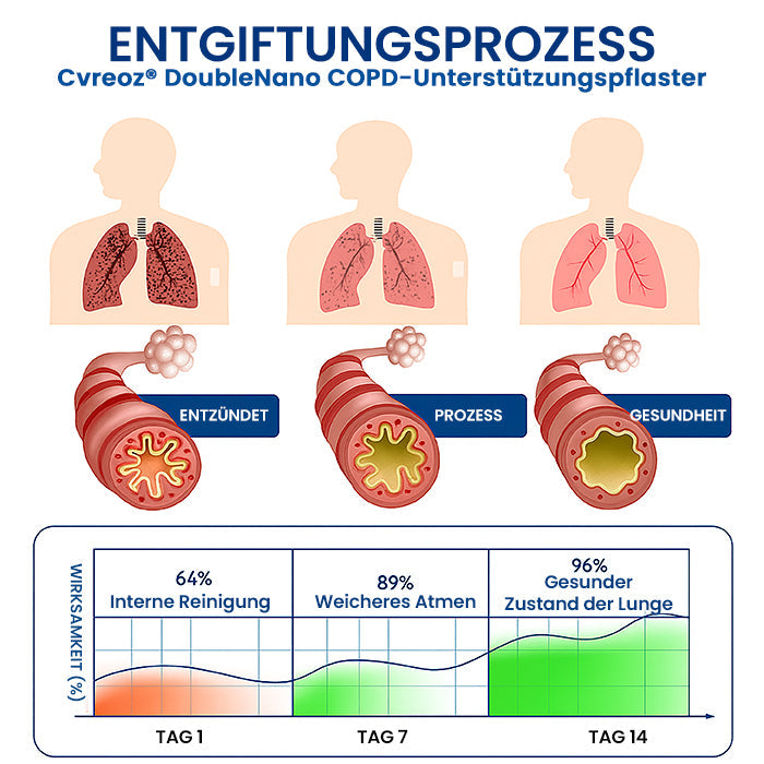 Cvreoz® DoubleNano COPD-Unterstützungspflaster | BEGRENZTES RABATTANGEBOT✨