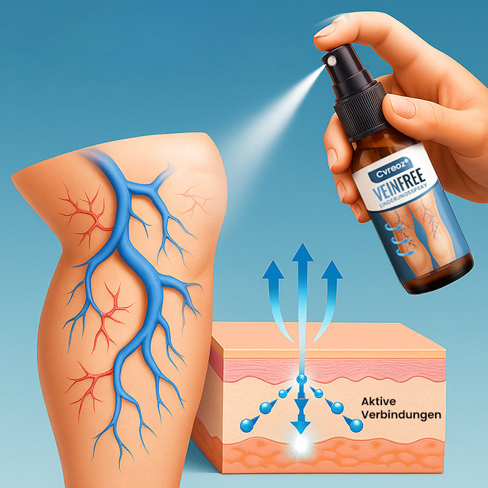 Cvreoz® VeinFree Linderungsspray |⚡BEGRENZTES RABATTANGEBOT⚡