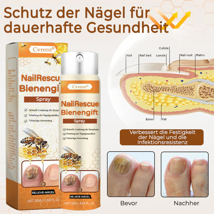 Cvreoz® NailRescue Bienengift-Spray - LIMITED-TIME OFFER | Lassen Sie das beste Selbstvertrauen in sich heraus!💕