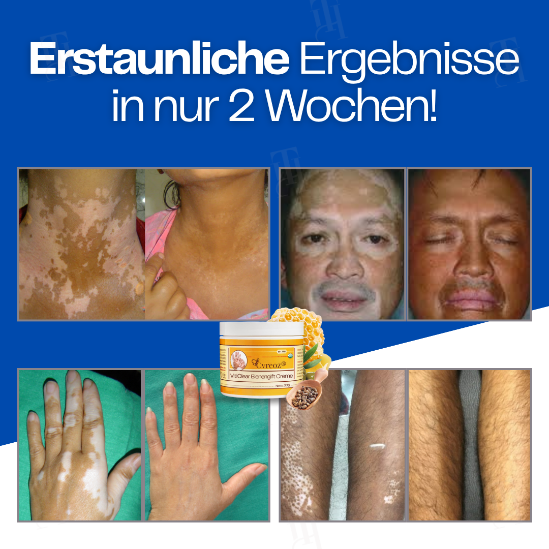 Cvreoz® VitiClear Bienengift Creme |Die Antwort der Natur für reine Haut✨