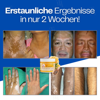 Cvreoz® VitiClear Bienengift Creme |Die Antwort der Natur für reine Haut✨